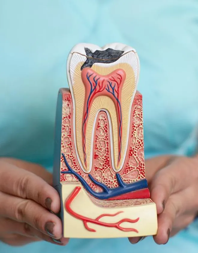 Modern Root Canal Union City procedure for painless dental care