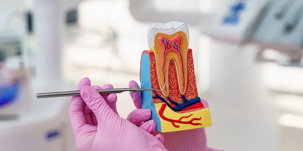 Root Canal vs. Tooth Extraction: What’s the Best Option 