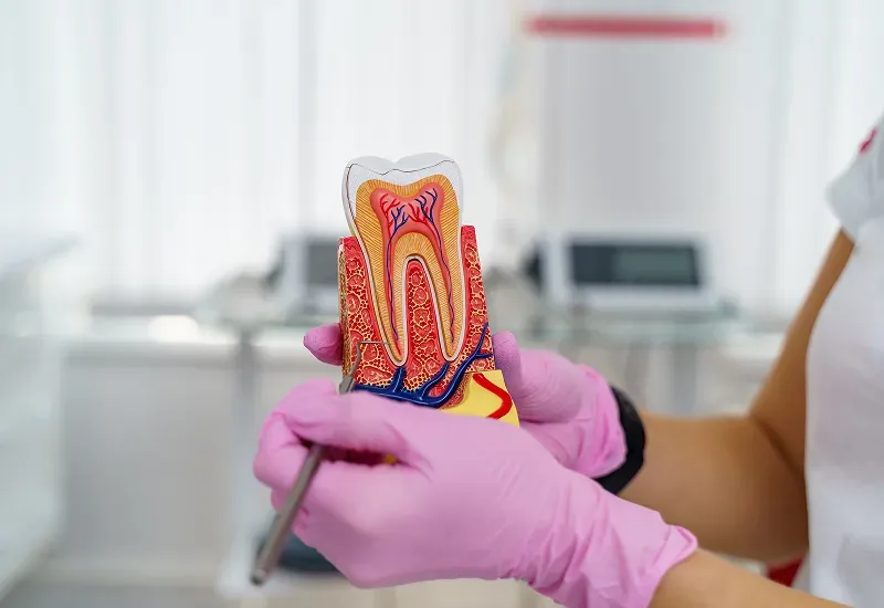 Signs You May Need a Root Canal