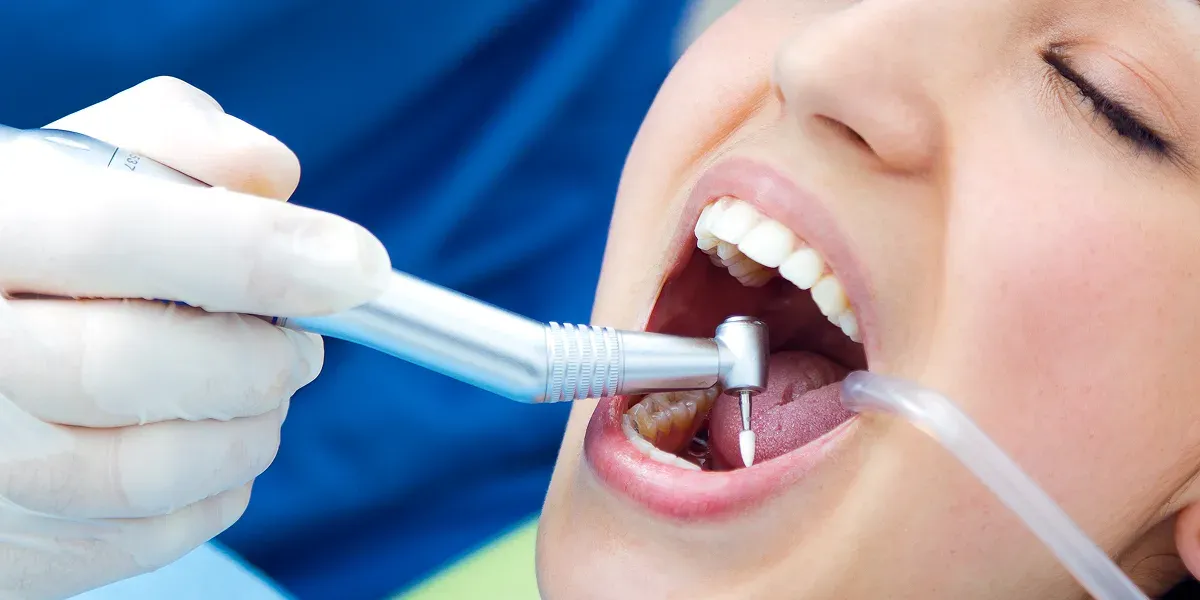 What Is a Root Canal? Understanding the Basics